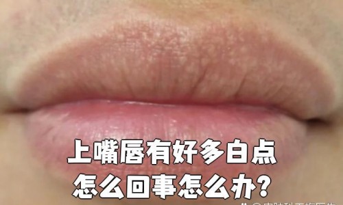 清热祛湿颗粒可以和龙胆泻肝丸一起服用吗-清热祛湿颗粒(众生 说明书网 :分享清热祛湿颗粒吃多久-清热祛湿颗粒功效作用知识
